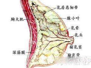 乳头溢液是乳腺癌的征兆吗